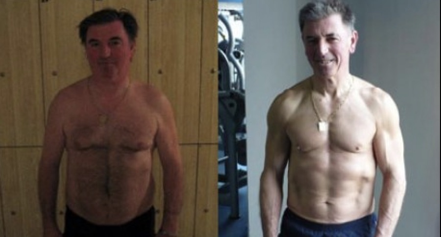 Carlos, 50 anos, antes e depois